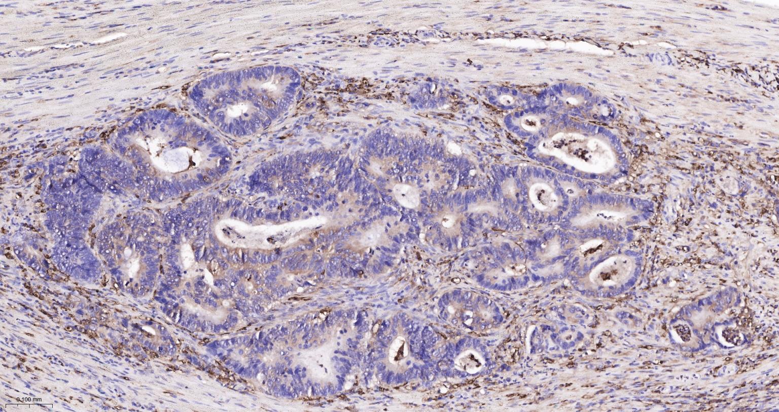 成纤维细胞生长因子21重组兔单抗
