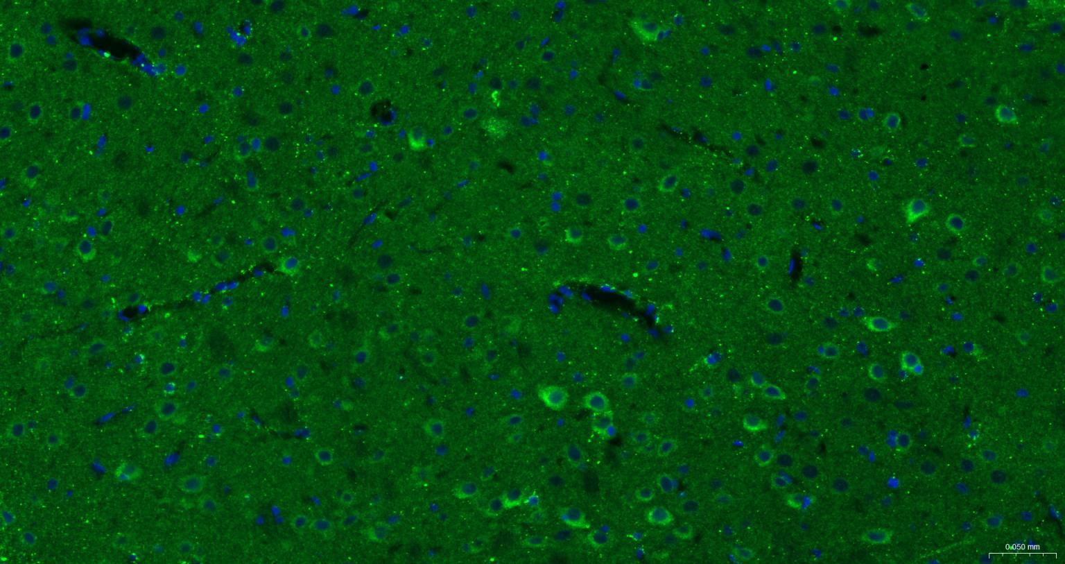 帕金蛋白重组兔单抗