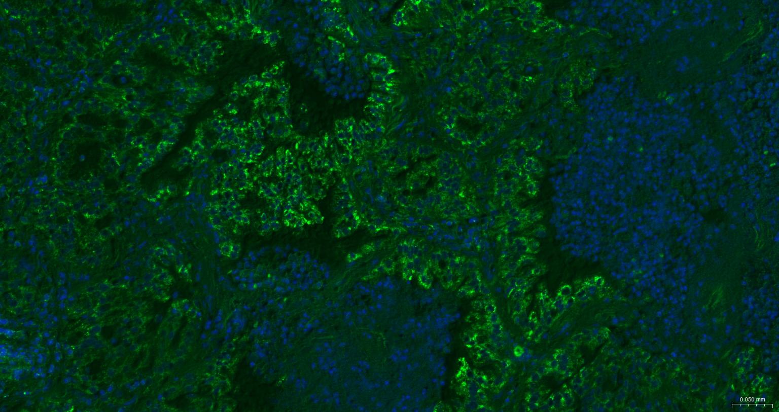 线粒体转录因子1重组兔单抗