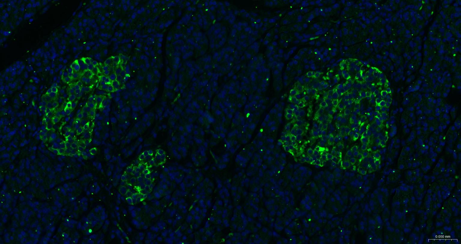 一种肿瘤抑制基因抗体