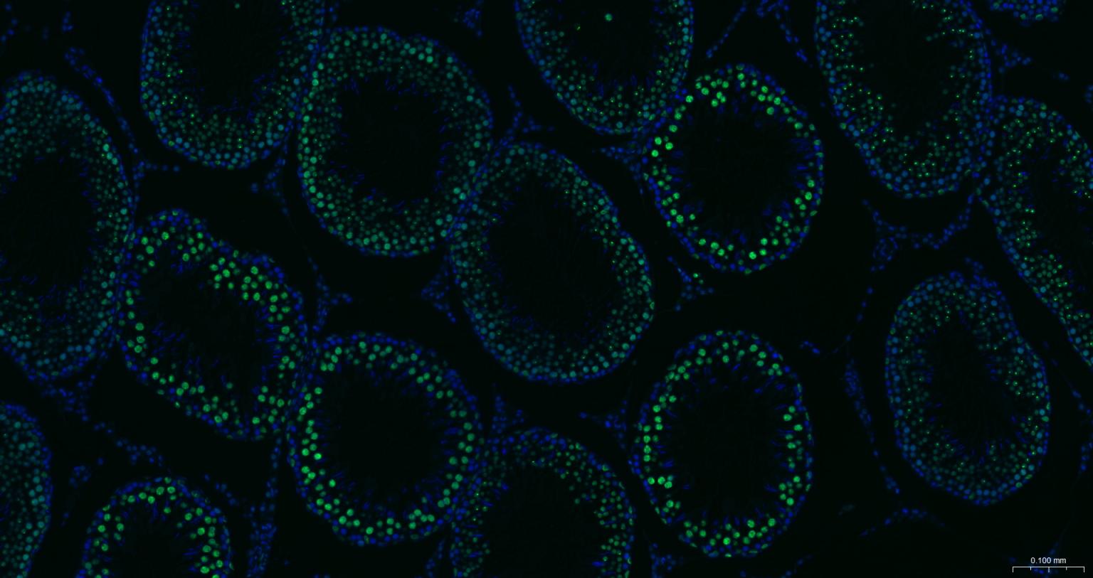 组蛋白去乙酰化酶1（核内参）重组兔单抗