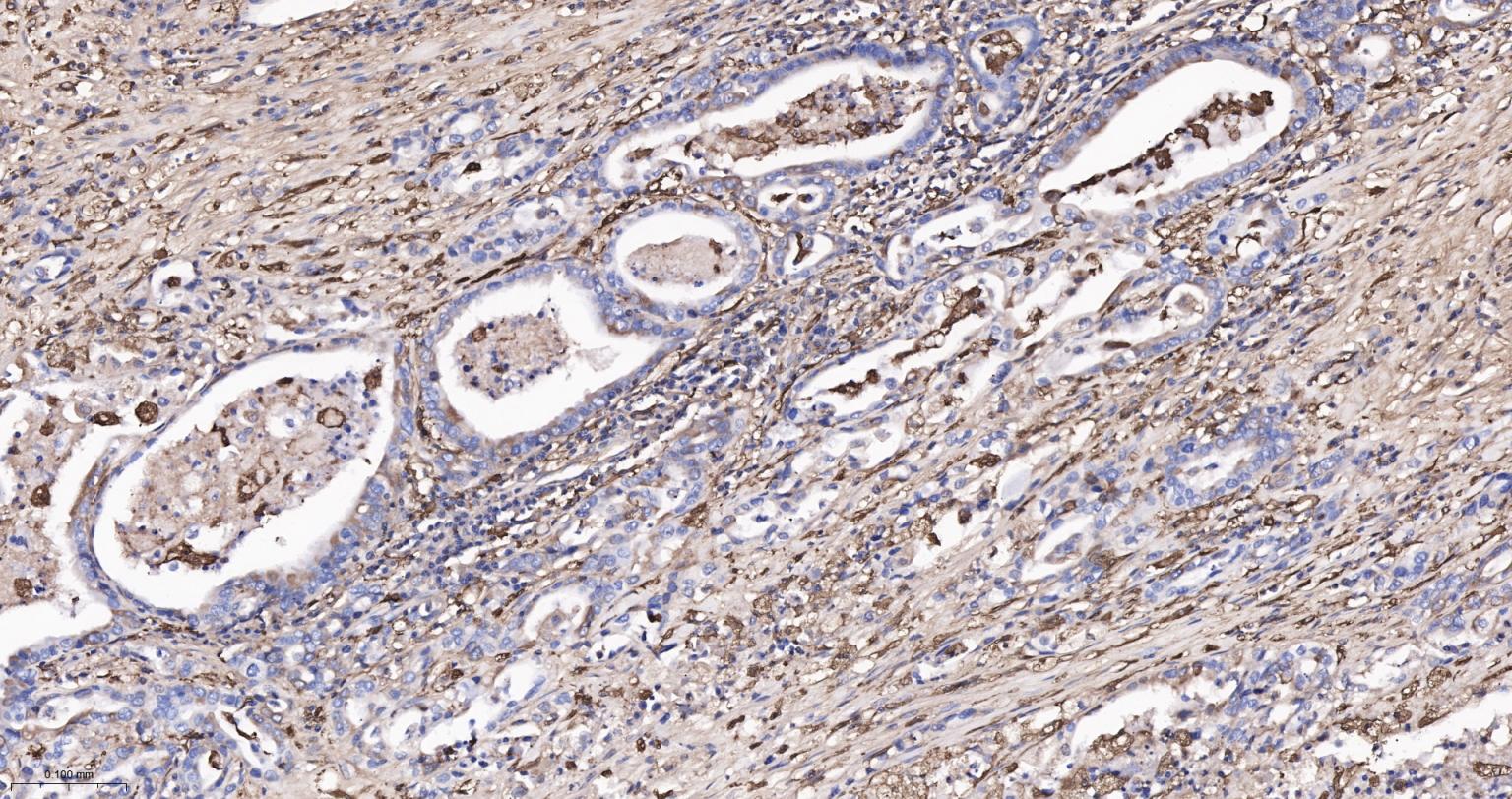 成纤维细胞生长因子21重组兔单抗