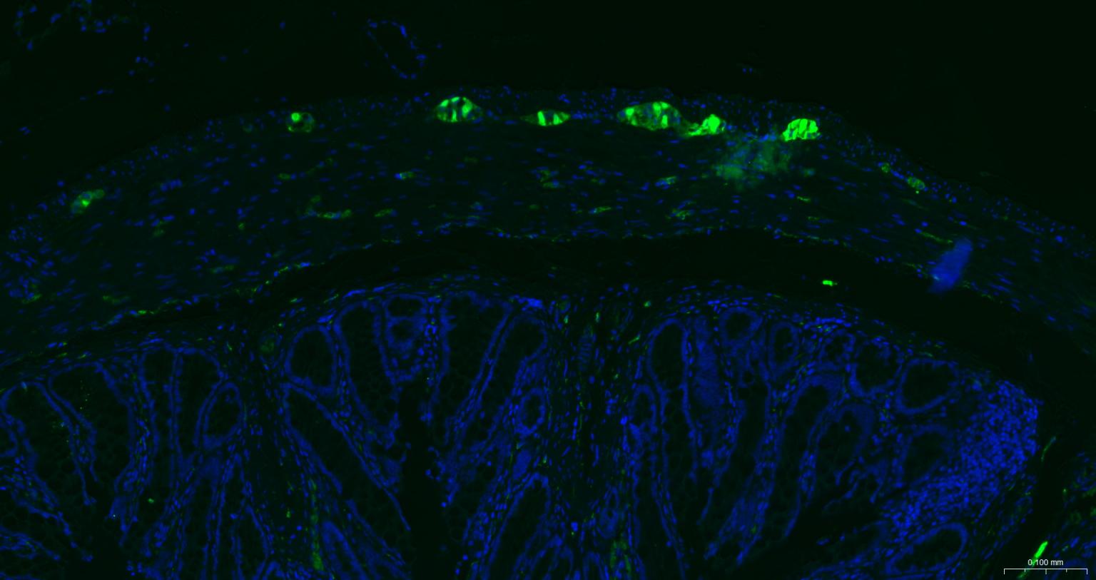 神经细胞胞浆蛋白9.5/蛋白基因产物9.5单克隆抗体-bsm-41257M