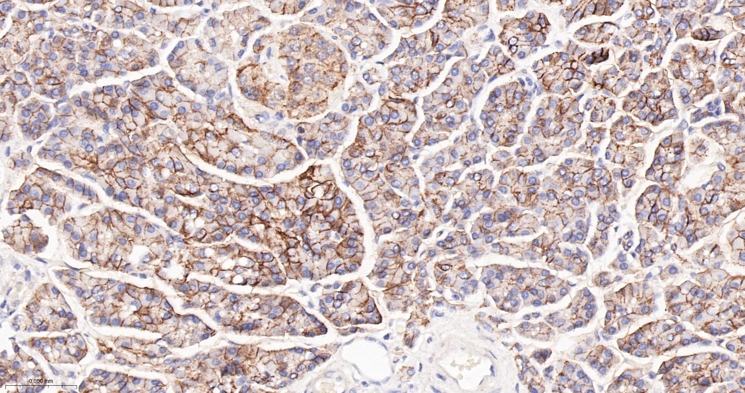 上皮特异性抗原（CD326）重组兔单克隆抗体