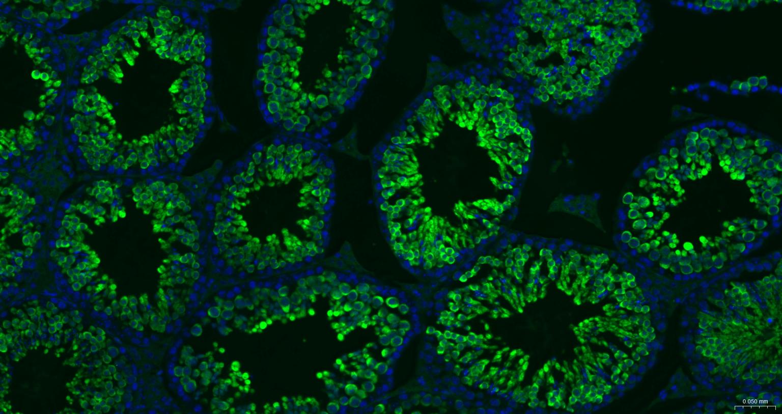 热休克蛋白-70重组兔单抗