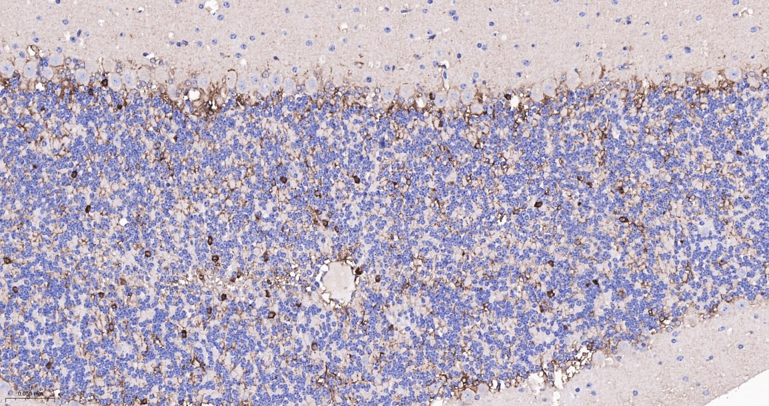 脑源神经营养因子重组兔单抗