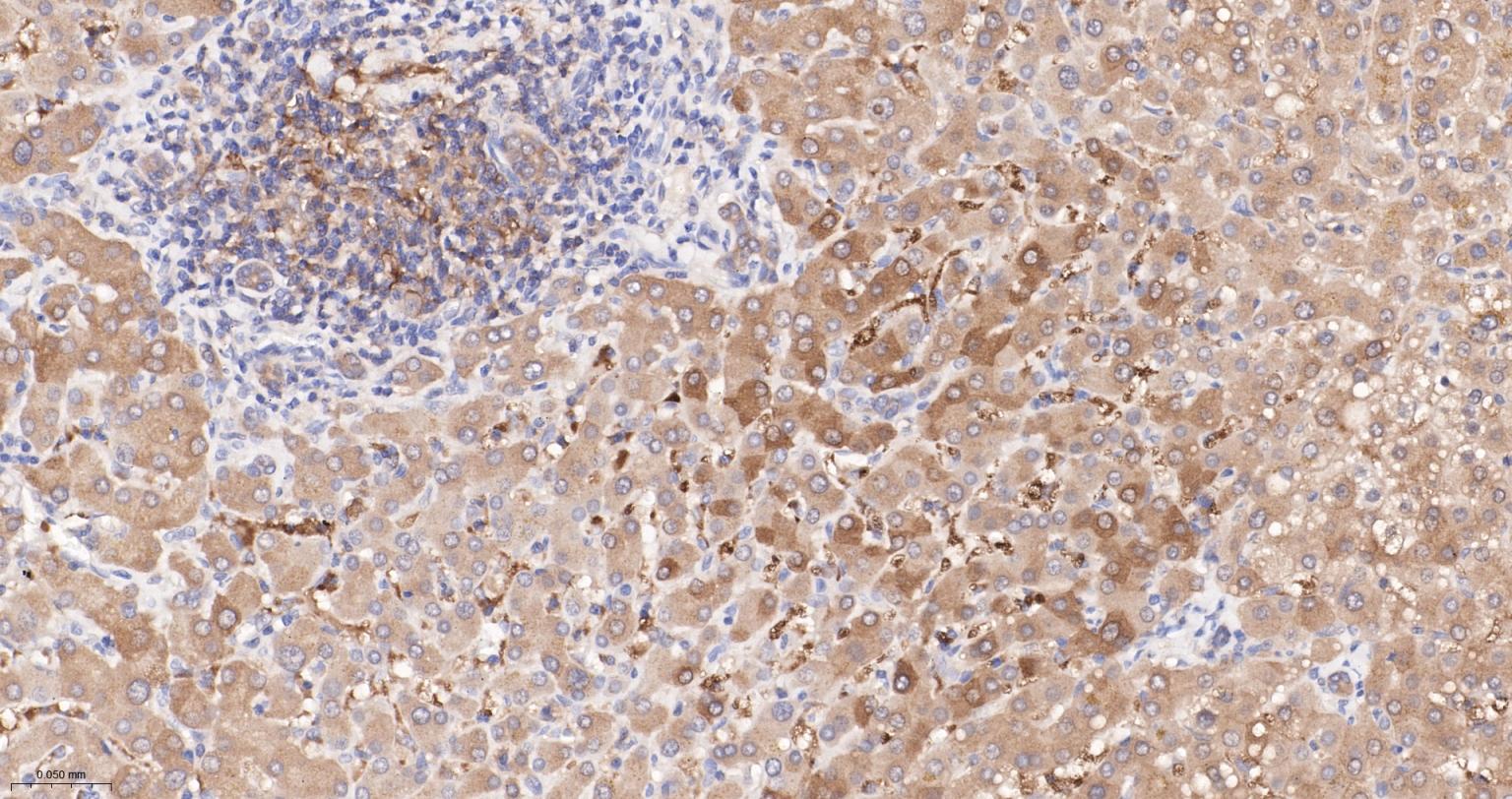 转铁蛋白受体（CD71）抗体