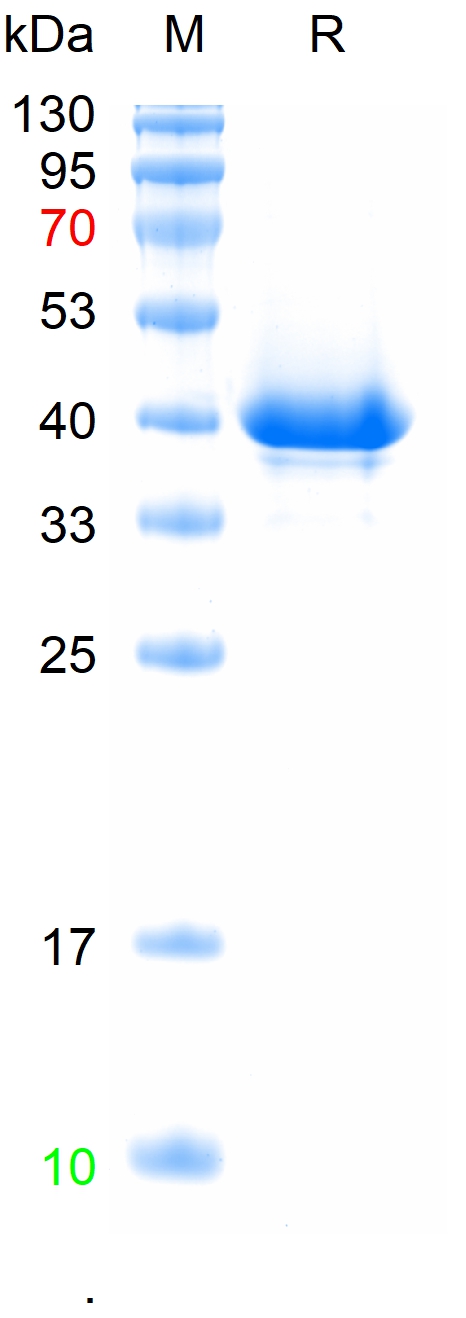 Recombinant Human GRIN2B Protein, N-His (重组蛋白) | Bioss