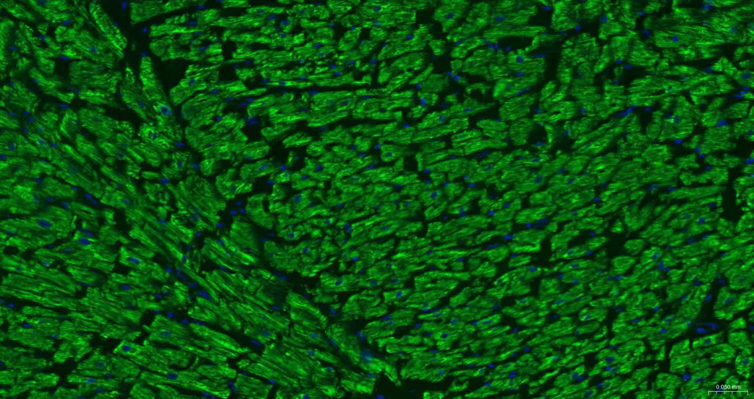 ATP5A重组兔单抗
