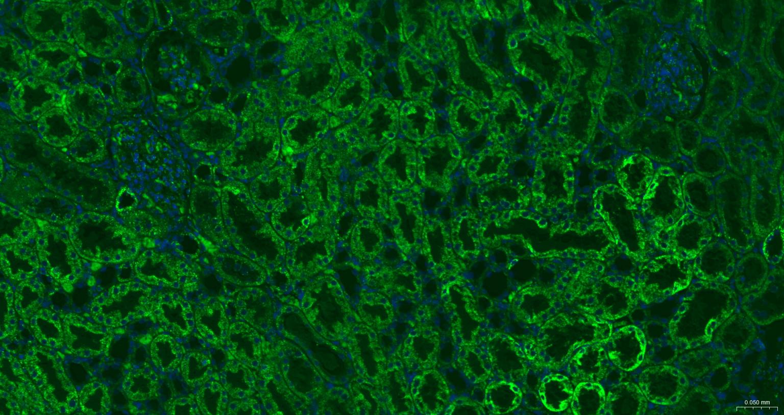ATP5A重组兔单抗