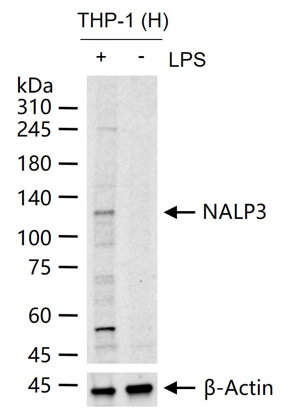 NALP3 Rabbit pAb (一抗) - WB | Bioss