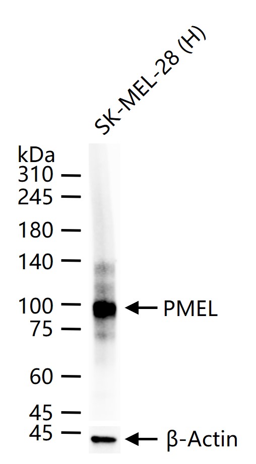 黑色素瘤相关抗原gp100重组兔单抗