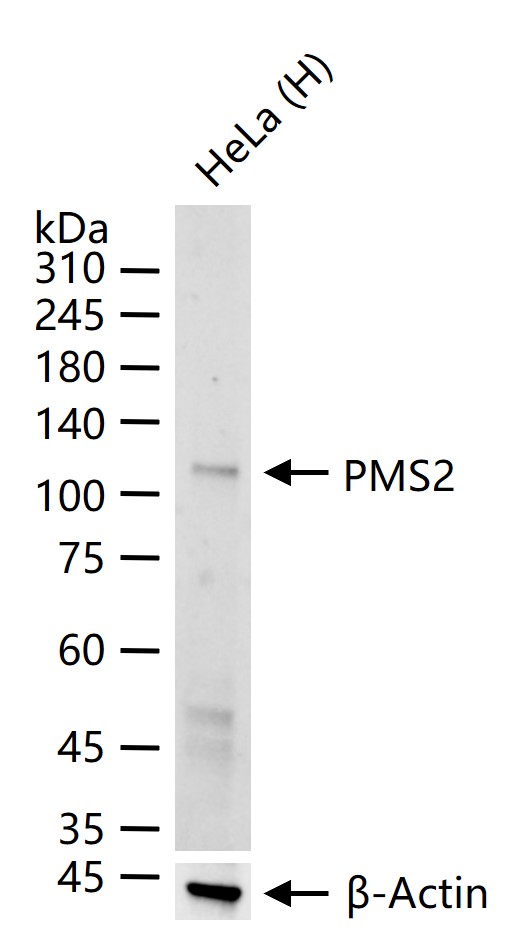 PMS2 Recombinant Rabbit mAb (一抗) - WB,IHC-P,IHC-F,IF | Bioss