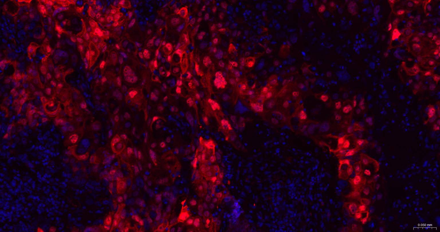 磷酸化热休克蛋白27重组兔单抗-bsm-52167R