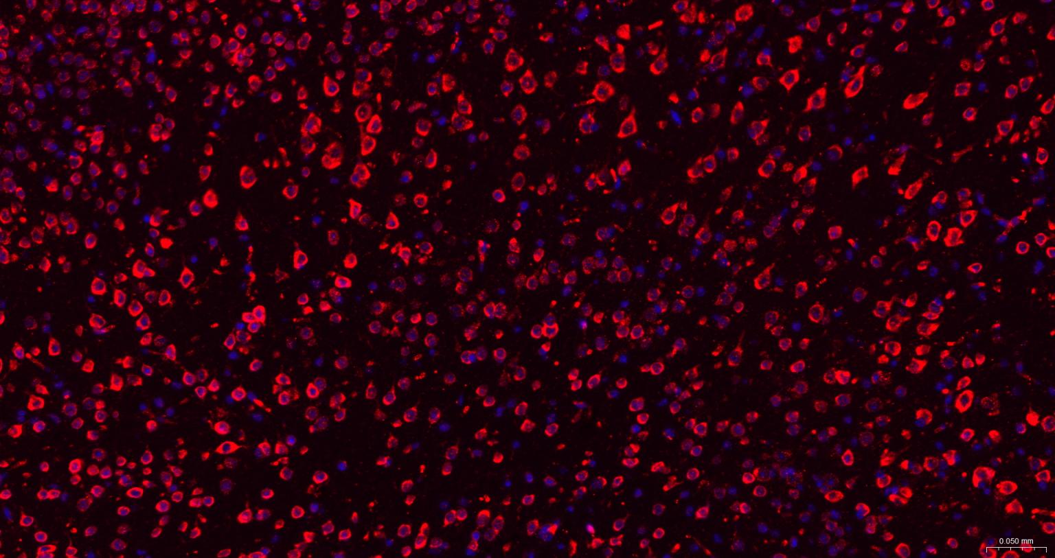 糖原合酶激酶-3β重组兔单抗