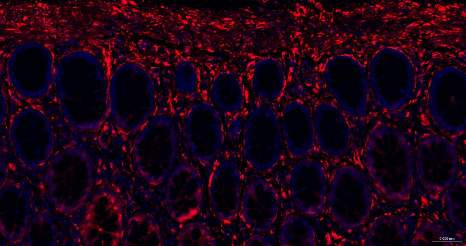 热休克蛋白27重组兔单抗