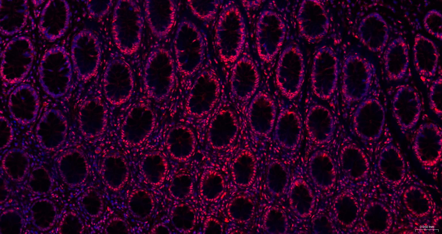 粘液样脂肪肉瘤蛋白FUS1重组兔单抗