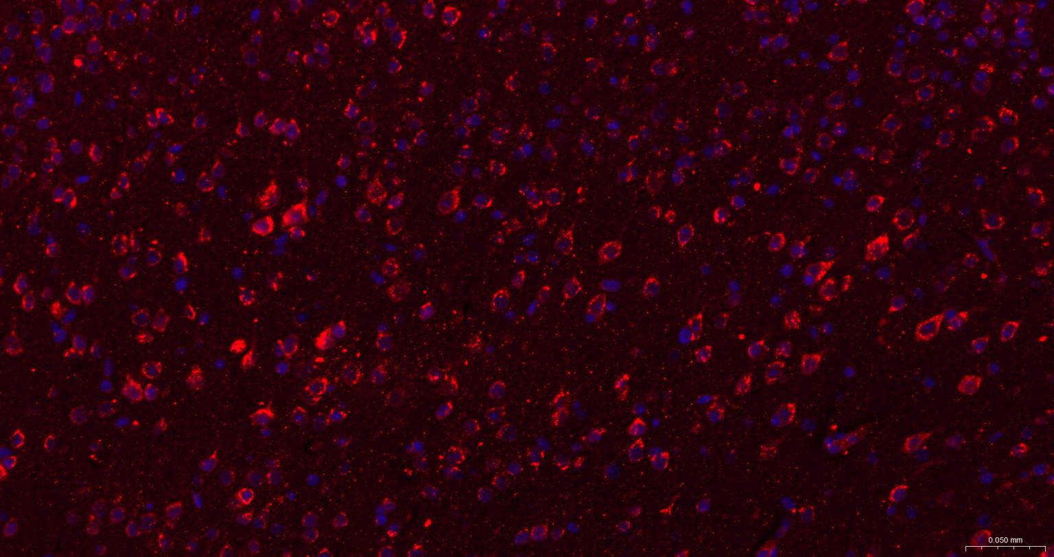 瞬时受体电位离子通道蛋白7重组兔单抗（M亚家族）