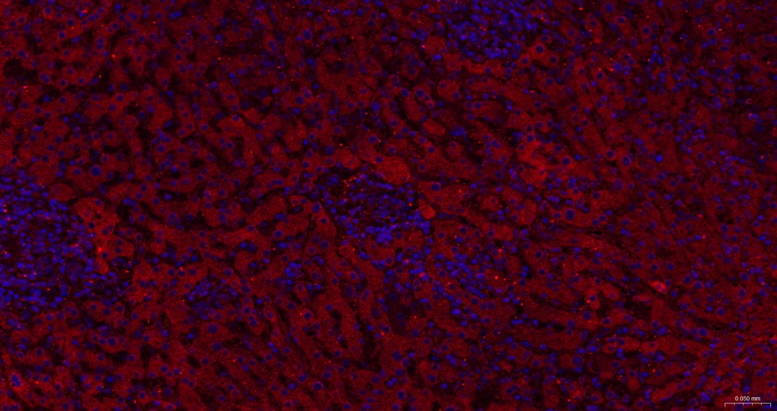 瞬时受体电位离子通道蛋白7重组兔单抗（M亚家族）