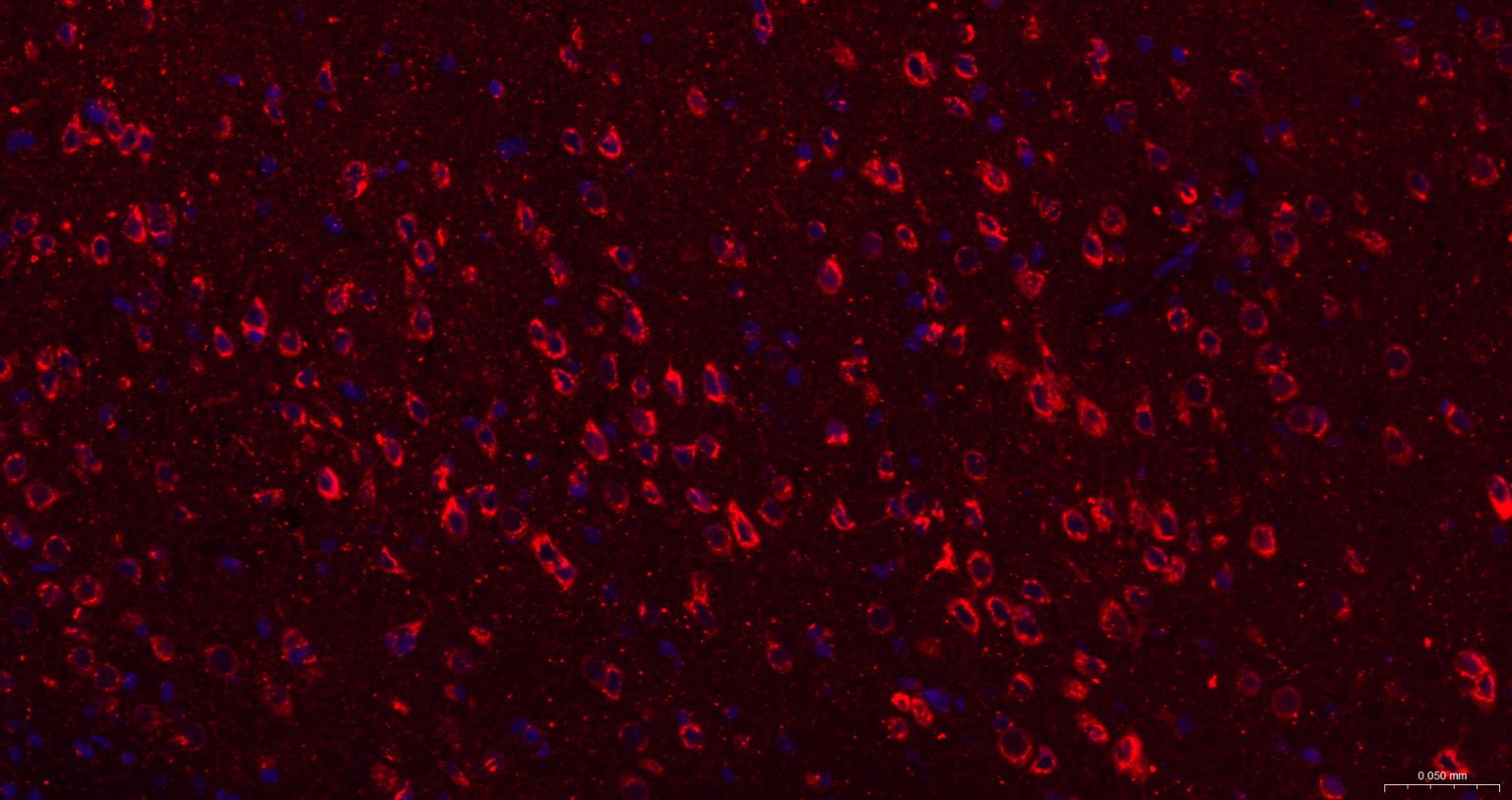瞬时受体电位离子通道蛋白7重组兔单抗（M亚家族）