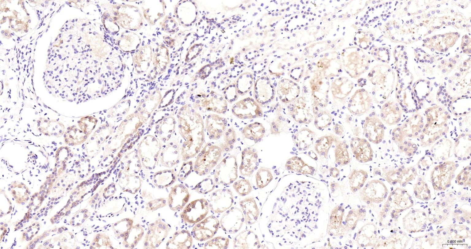 组蛋白去乙酰化酶6抗体-bs-2811R