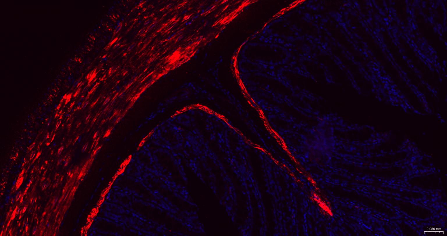 热休克蛋白27重组兔单抗