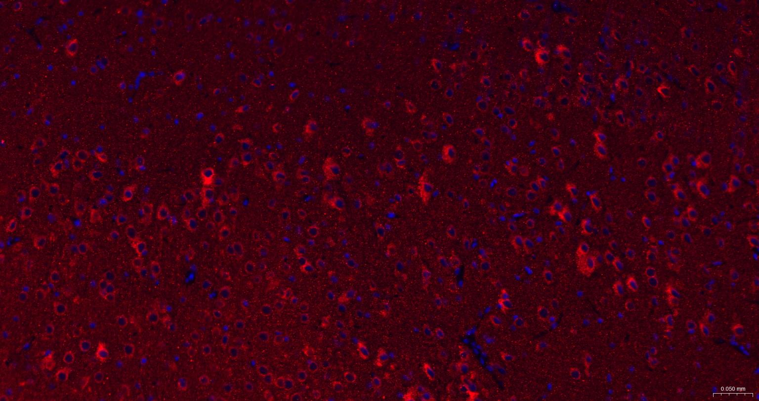 泛素结合蛋白P62抗体-bs-55207R