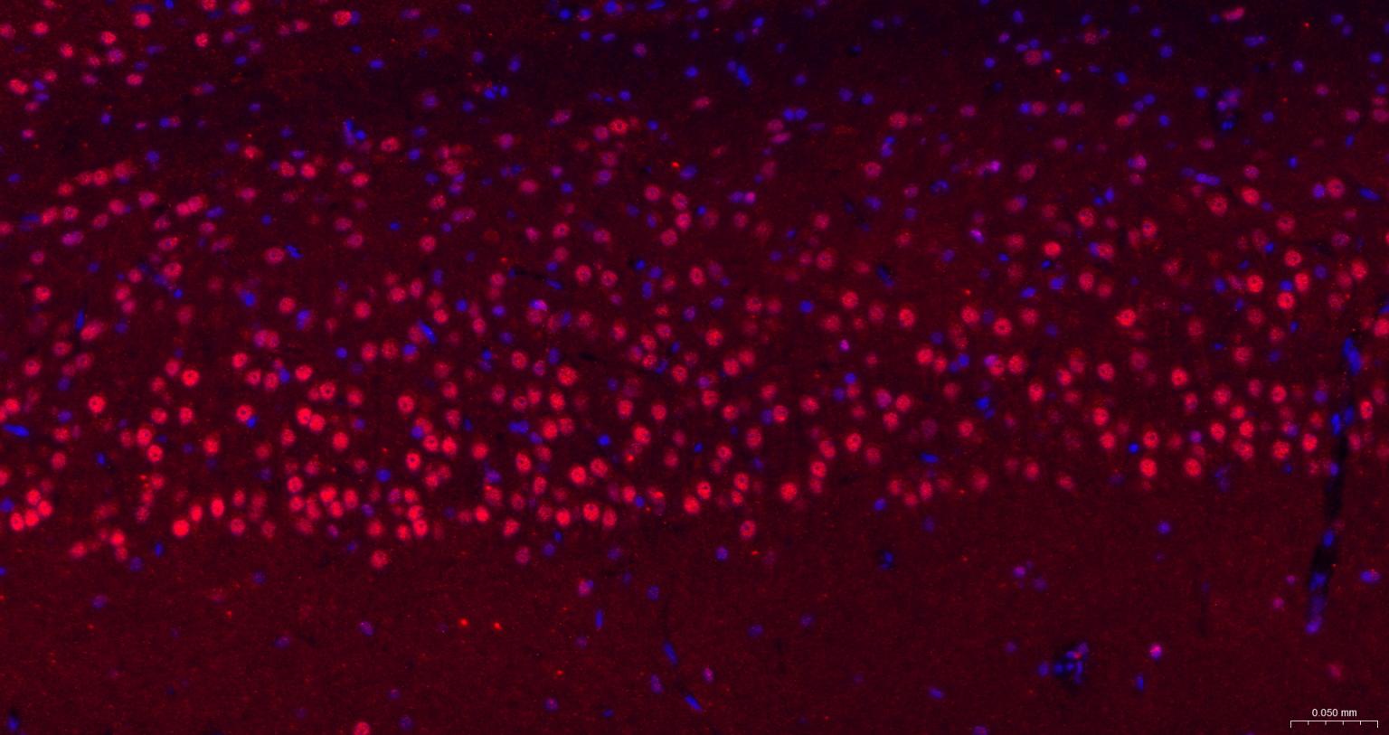 粘液样脂肪肉瘤蛋白FUS1重组兔单抗