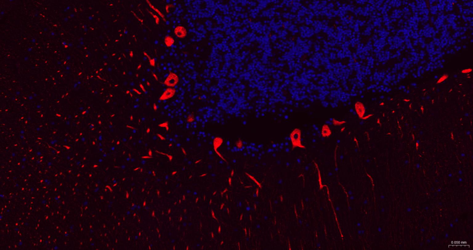5-三磷酸肌醇受体1重组兔单抗