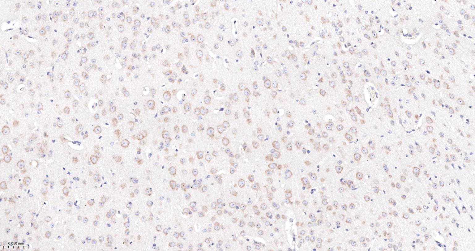 COPA蛋白重组兔单抗-bsm-62114R