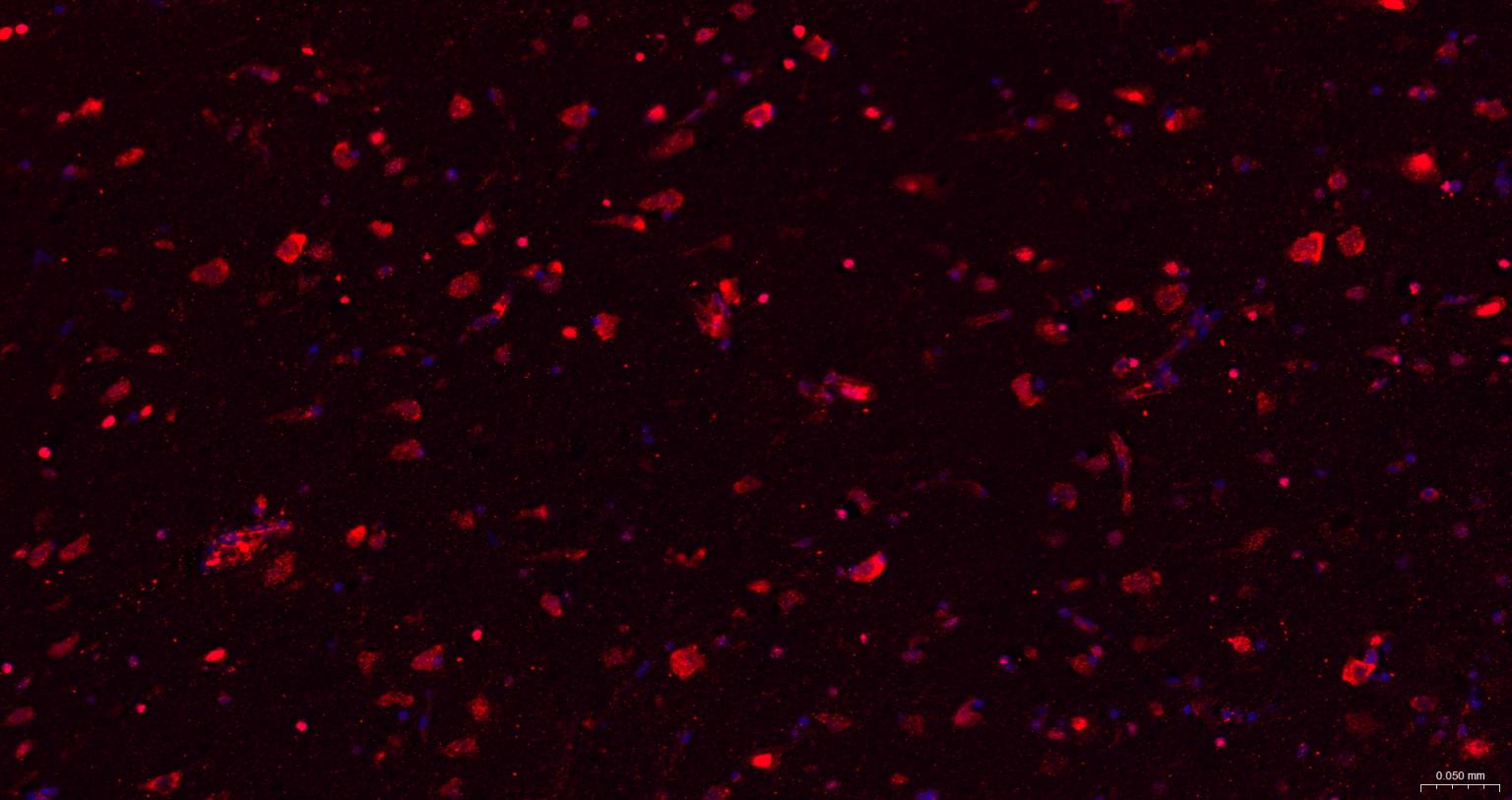 糖原合酶激酶-3β重组兔单抗