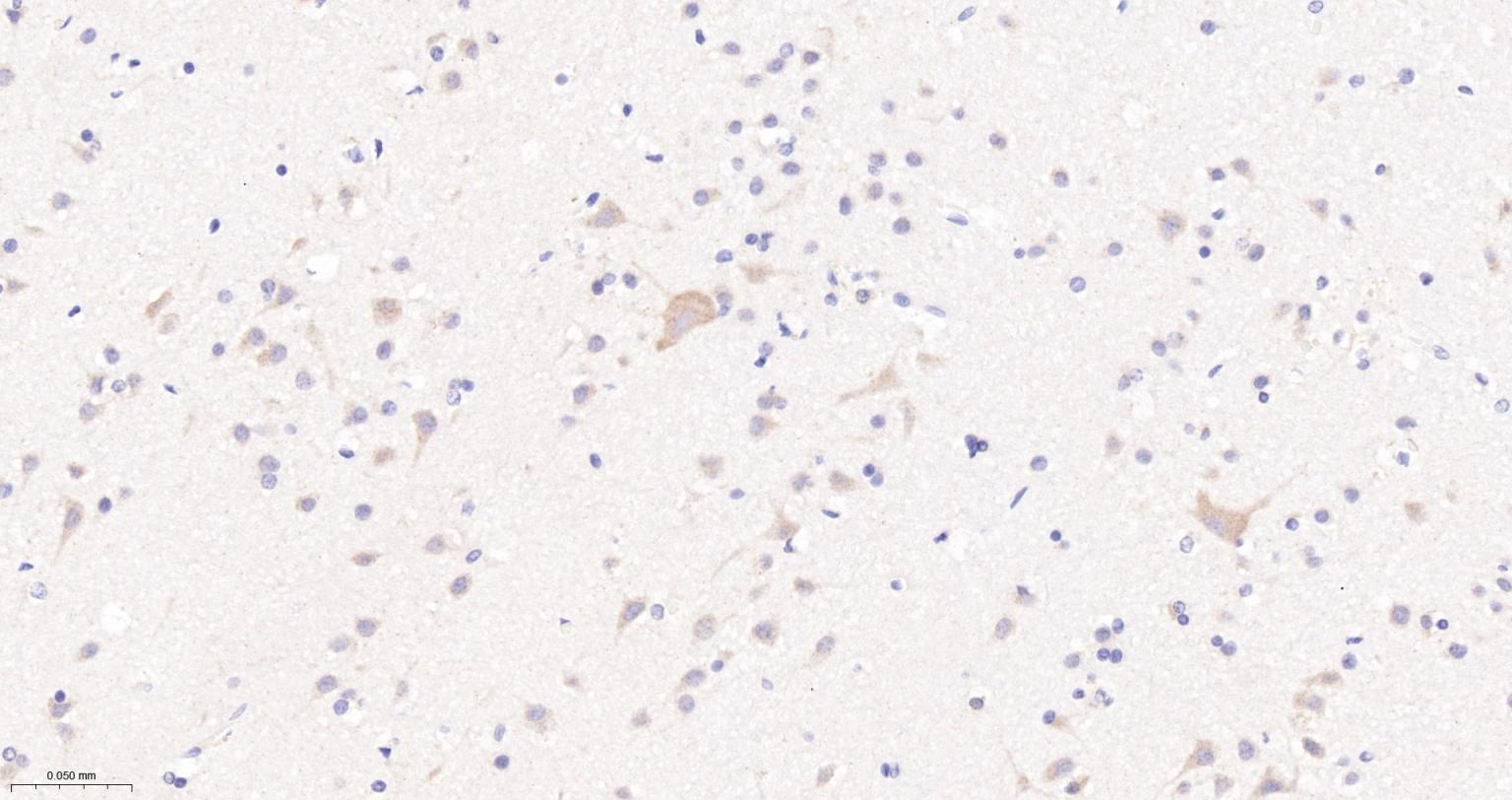 COPA蛋白重组兔单抗-bsm-62114R