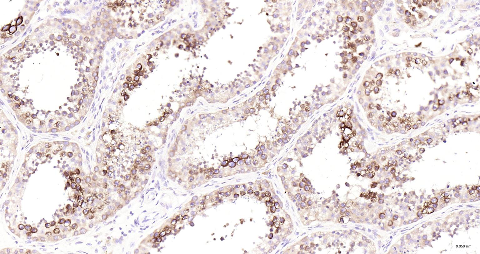 组蛋白去乙酰化酶6抗体-bs-2811R