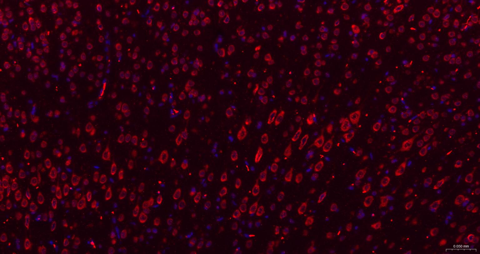 糖原合酶激酶-3β重组兔单抗