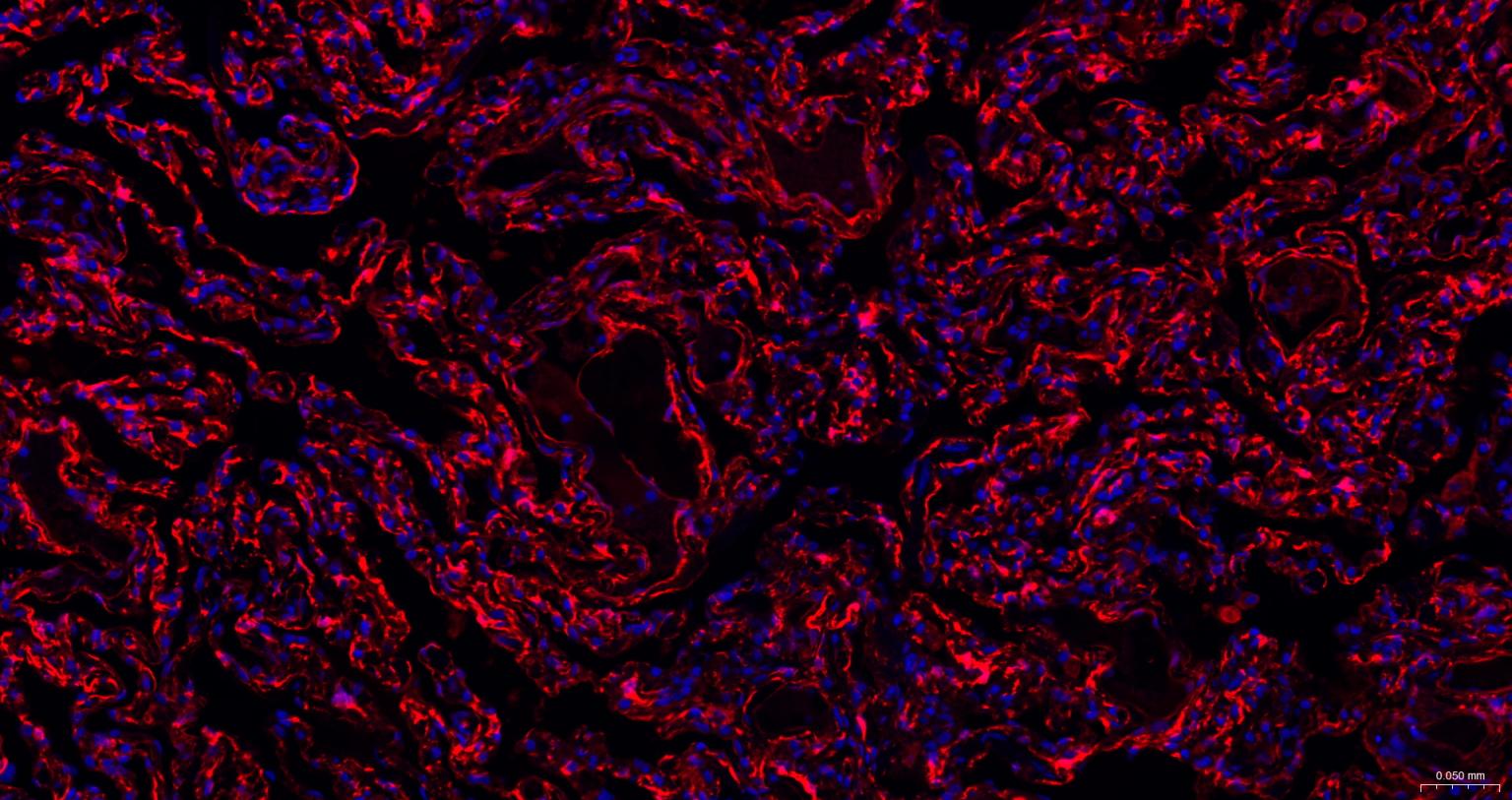 谷氨酰胺转胺酶2重组鼠单抗-bsm-55524M