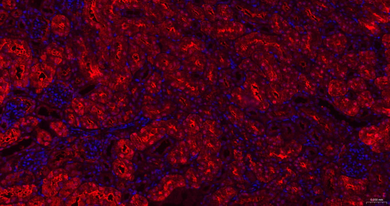 超氧化物歧化酶1重组兔单抗
