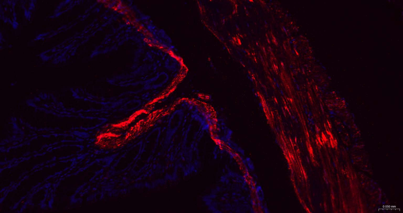 热休克蛋白27重组兔单抗