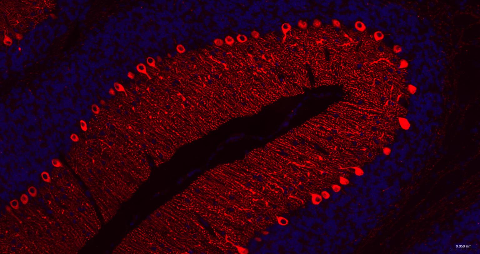 5-三磷酸肌醇受体1重组兔单抗