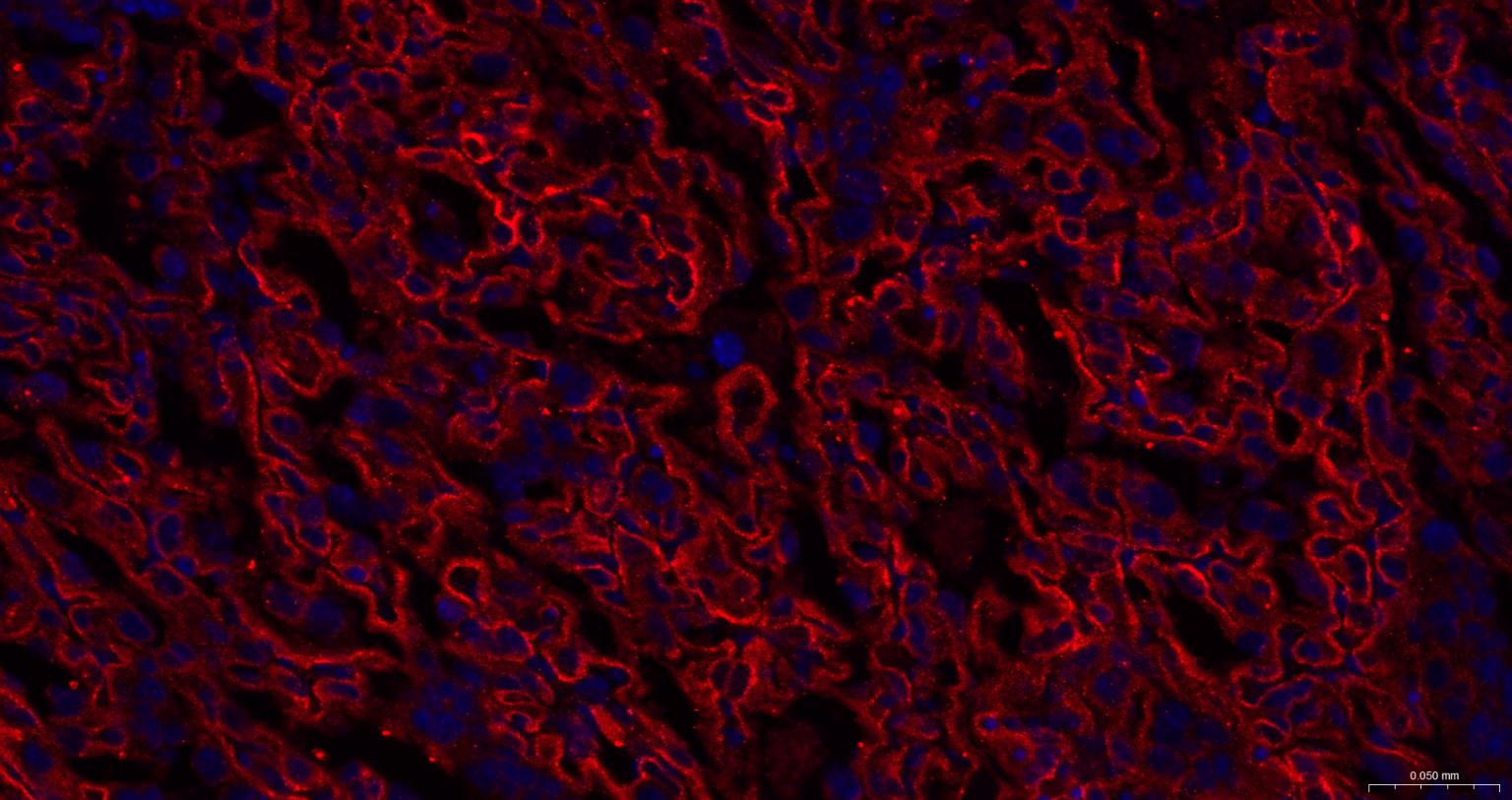 谷氨酰胺转胺酶2重组兔单抗