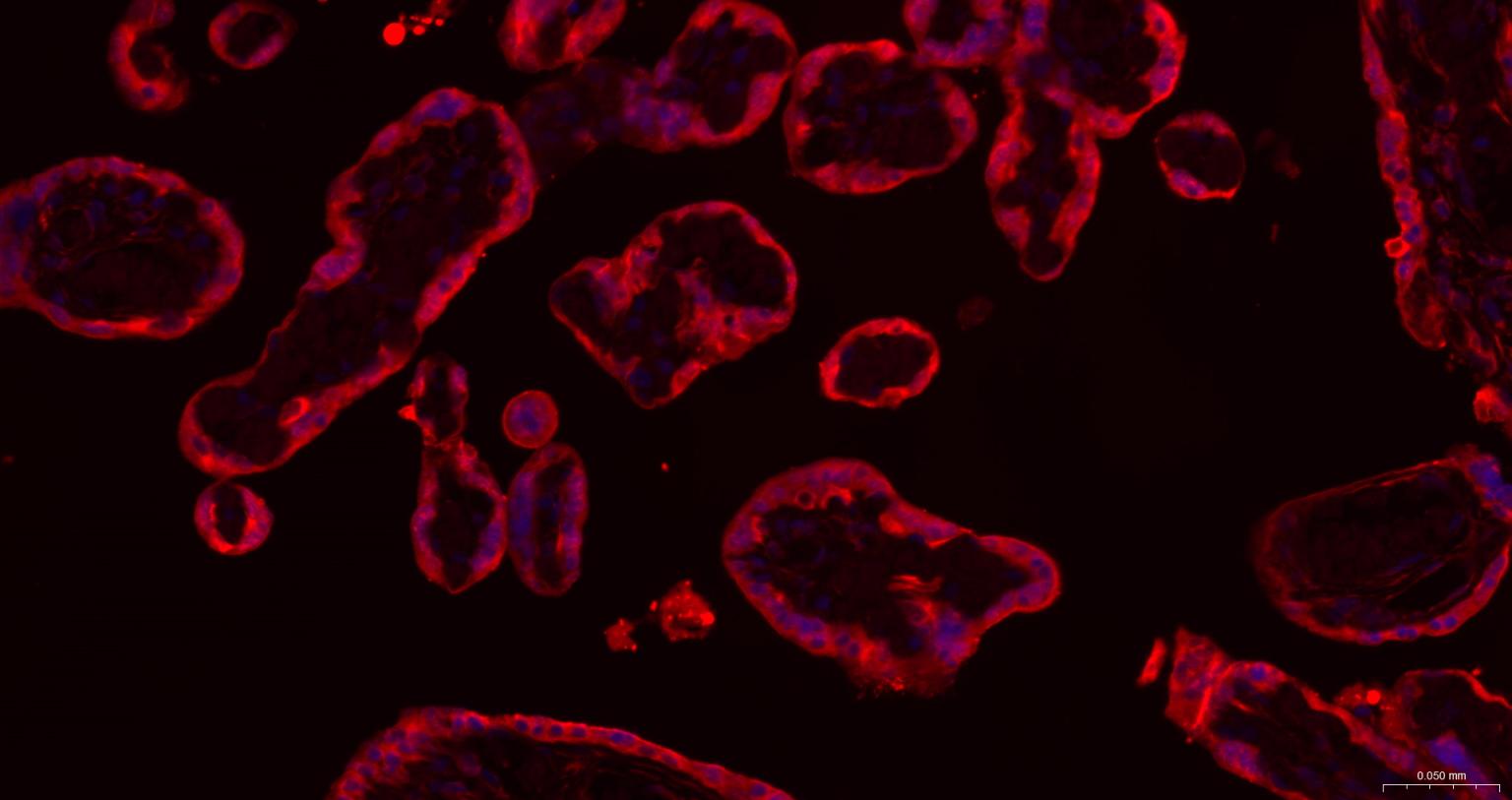谷氨酰胺转胺酶2重组鼠单抗-bsm-55524M