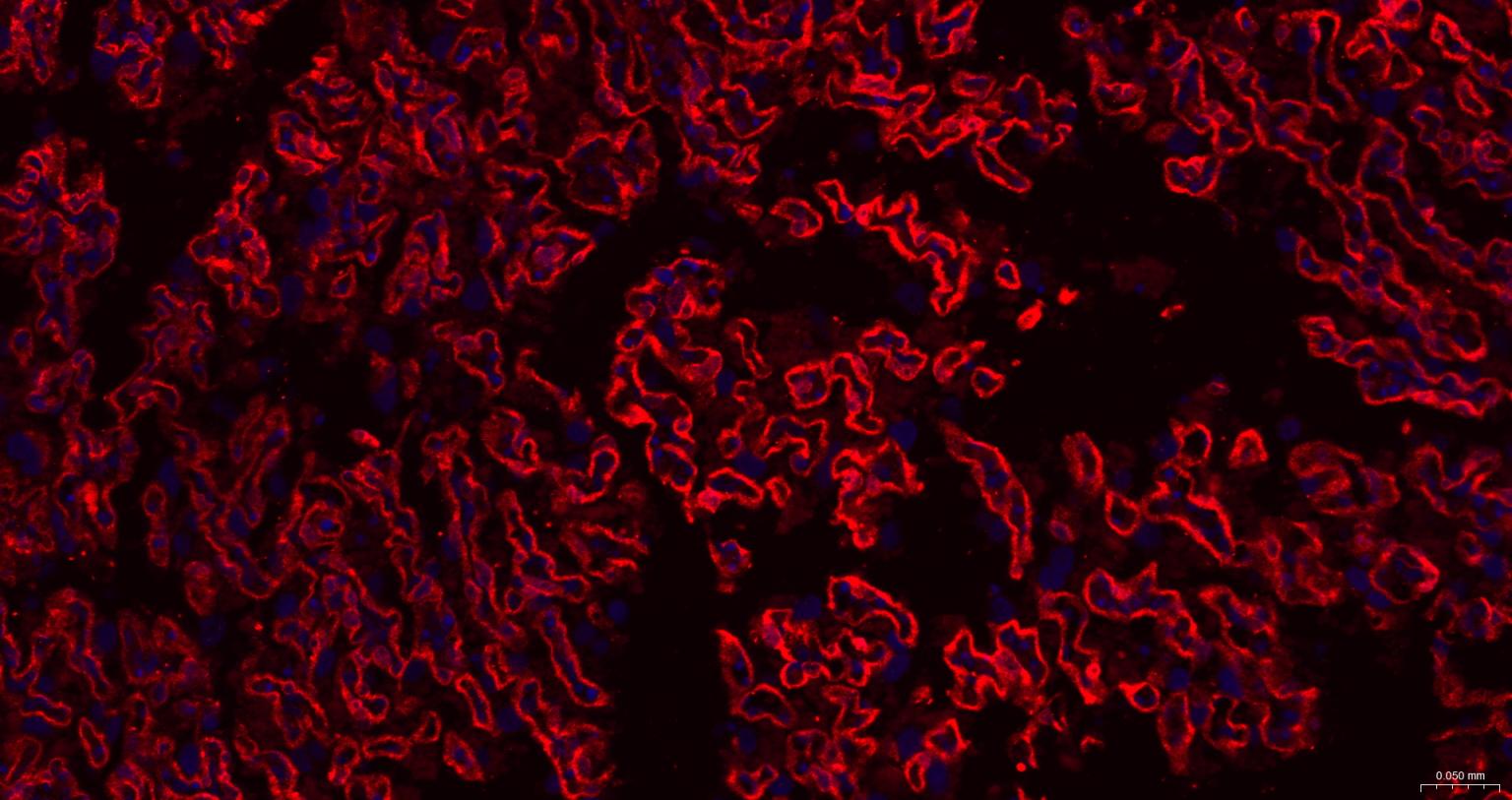 谷氨酰胺转胺酶2重组兔单抗