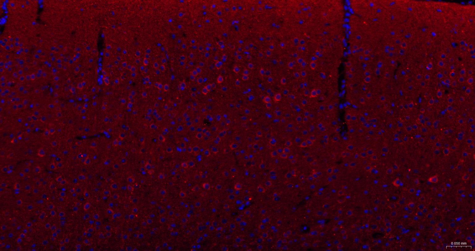 泛素结合蛋白P62重组兔单抗