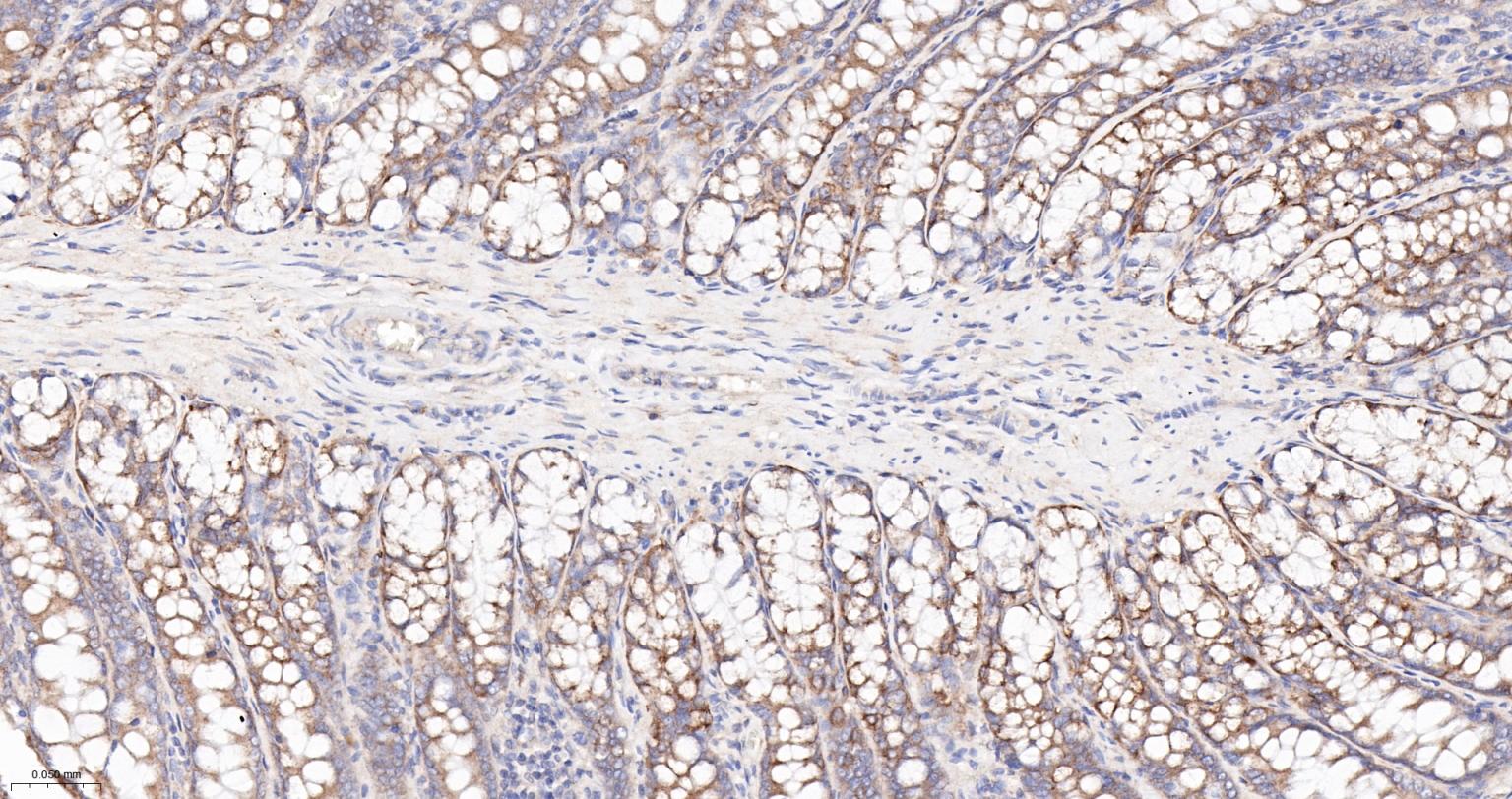 COPA蛋白重组兔单抗-bsm-62114R