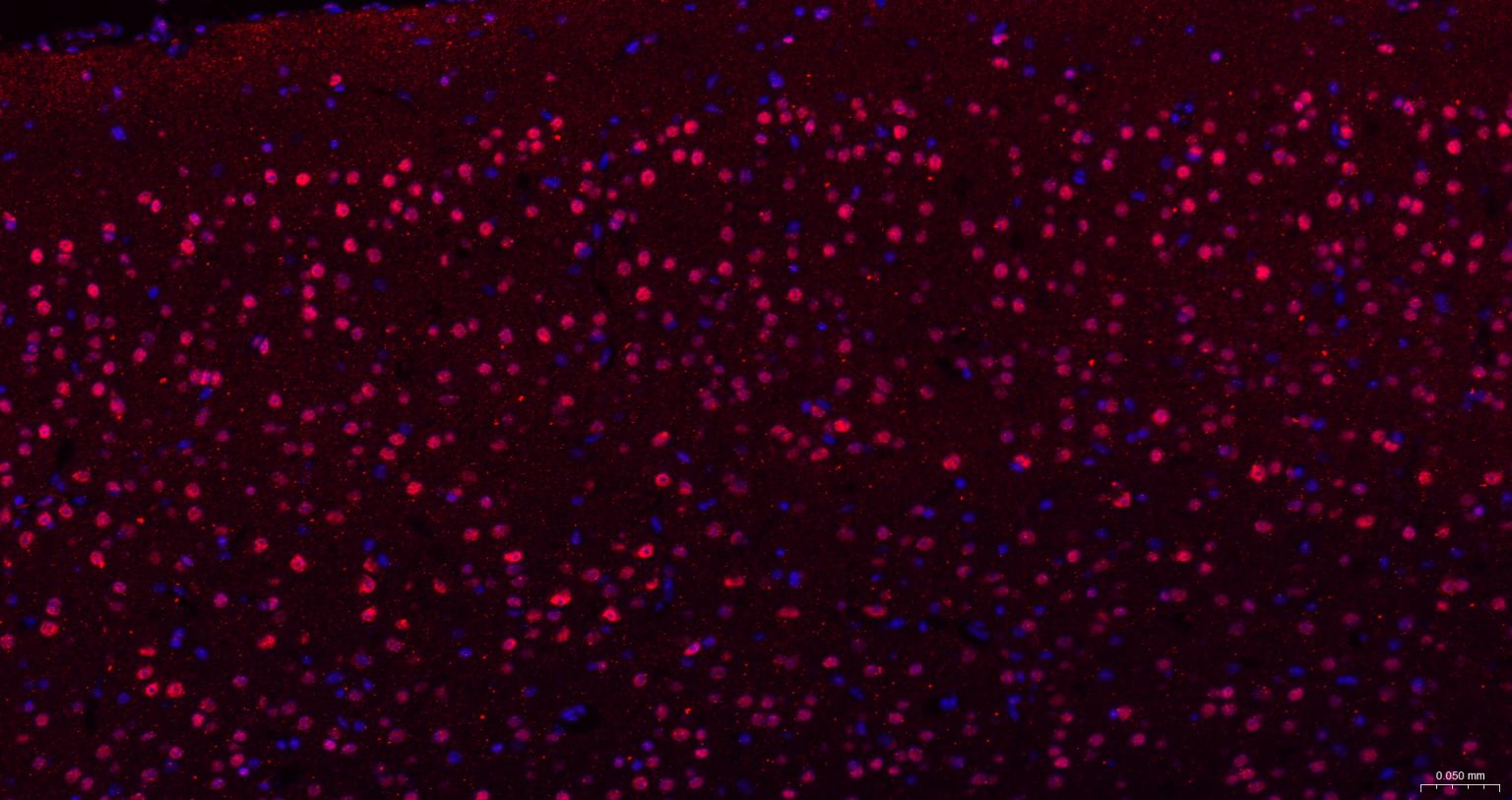 粘液样脂肪肉瘤蛋白FUS1重组兔单抗