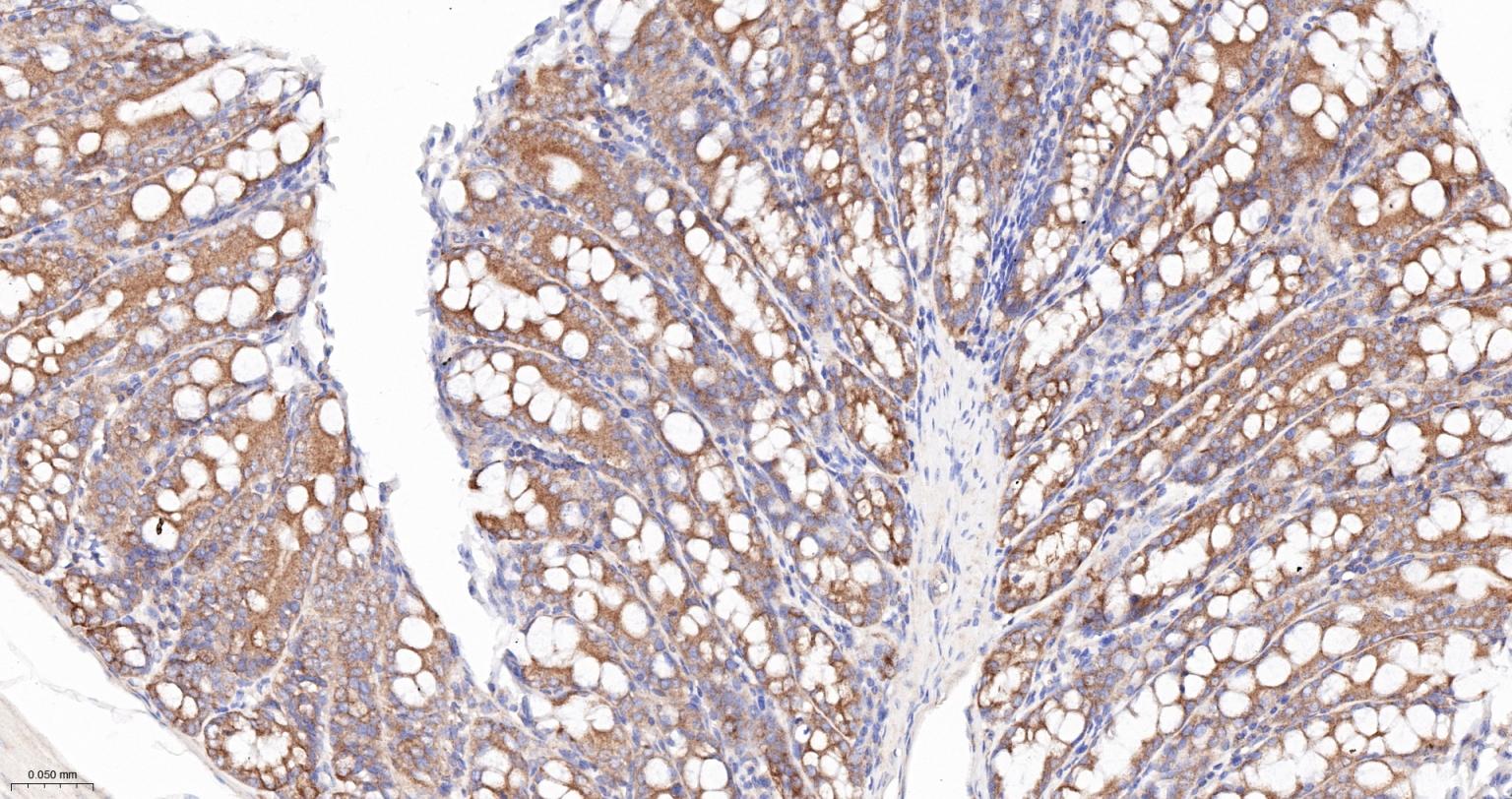 COPA蛋白重组兔单抗-bsm-62114R