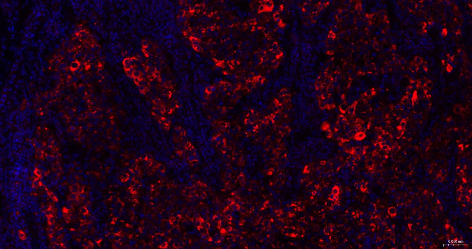 泛素结合蛋白P62重组兔单抗