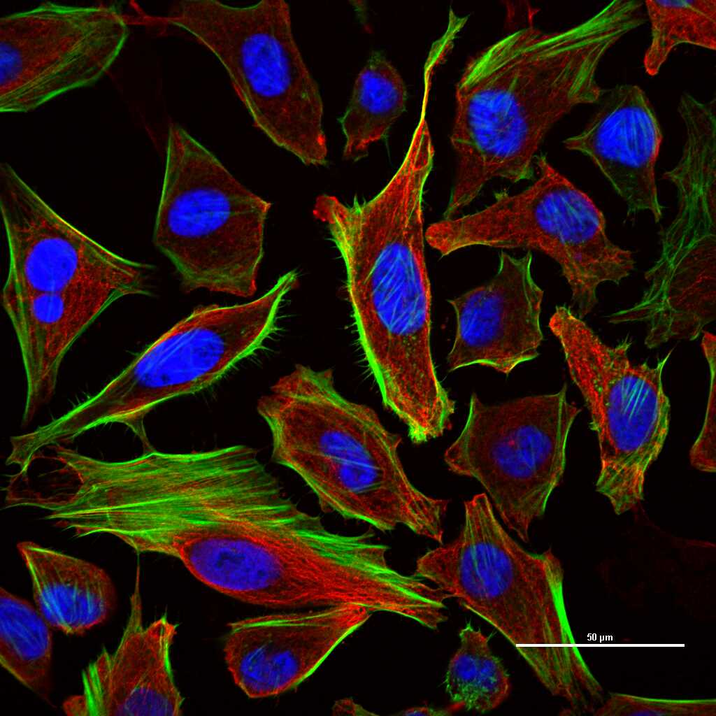 微管蛋白β tubulin/Tubulin β(内参)重组兔单抗