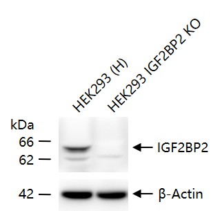胰岛素样生长因子ⅡmRNA结合蛋白2重组兔单抗