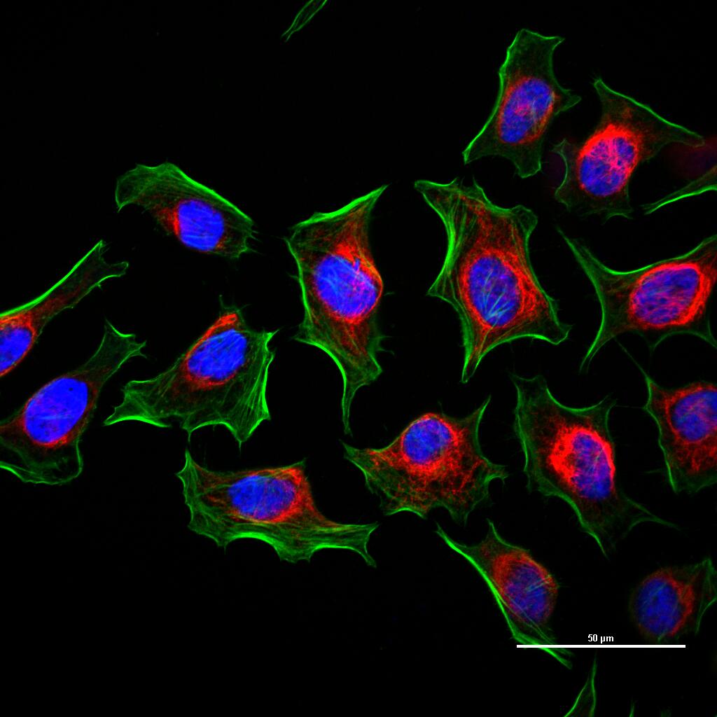 Vimentin Mouse mAb (一抗) - WB,IHC-P,IHC-F,IF,Flow-Cyt,ICC/IF | Bioss