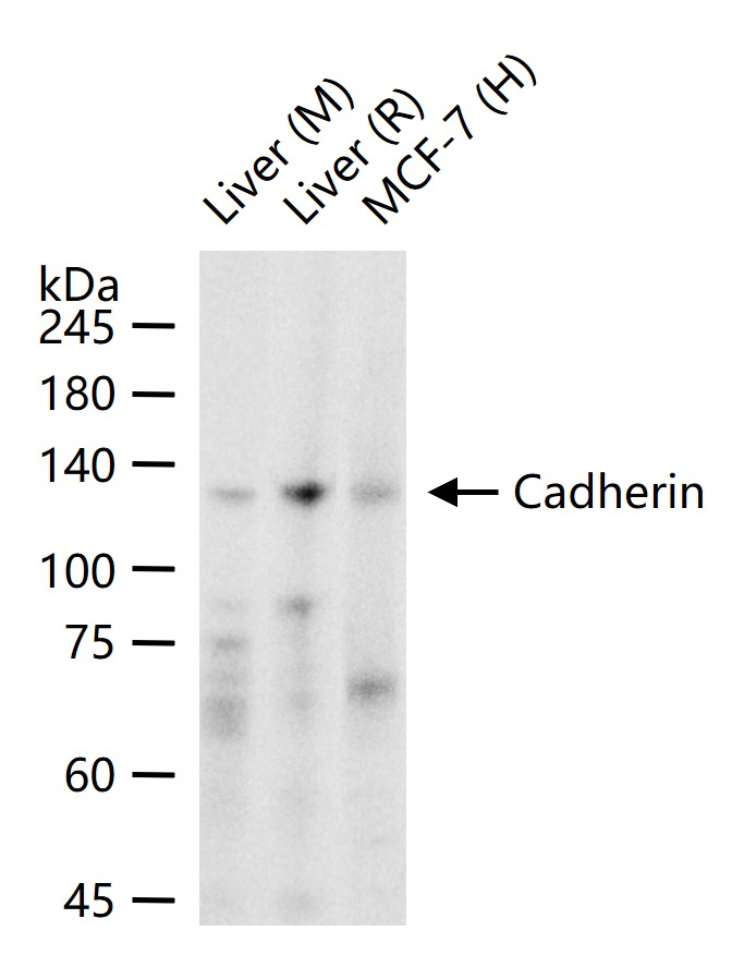 上皮钙粘附分子重组兔单抗
